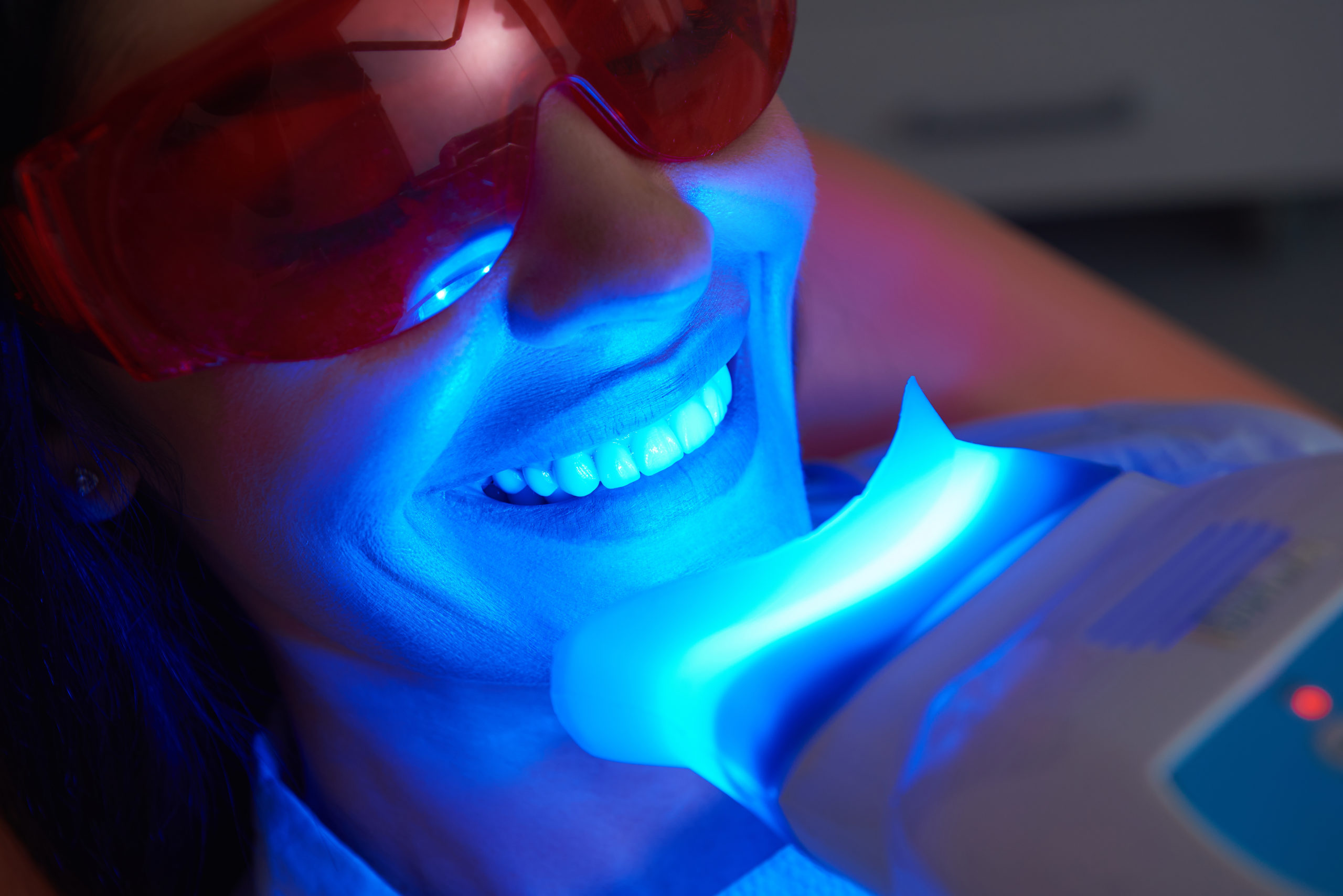 WYBIELANIE zębów jednowizytowe – wyniki naszych testów